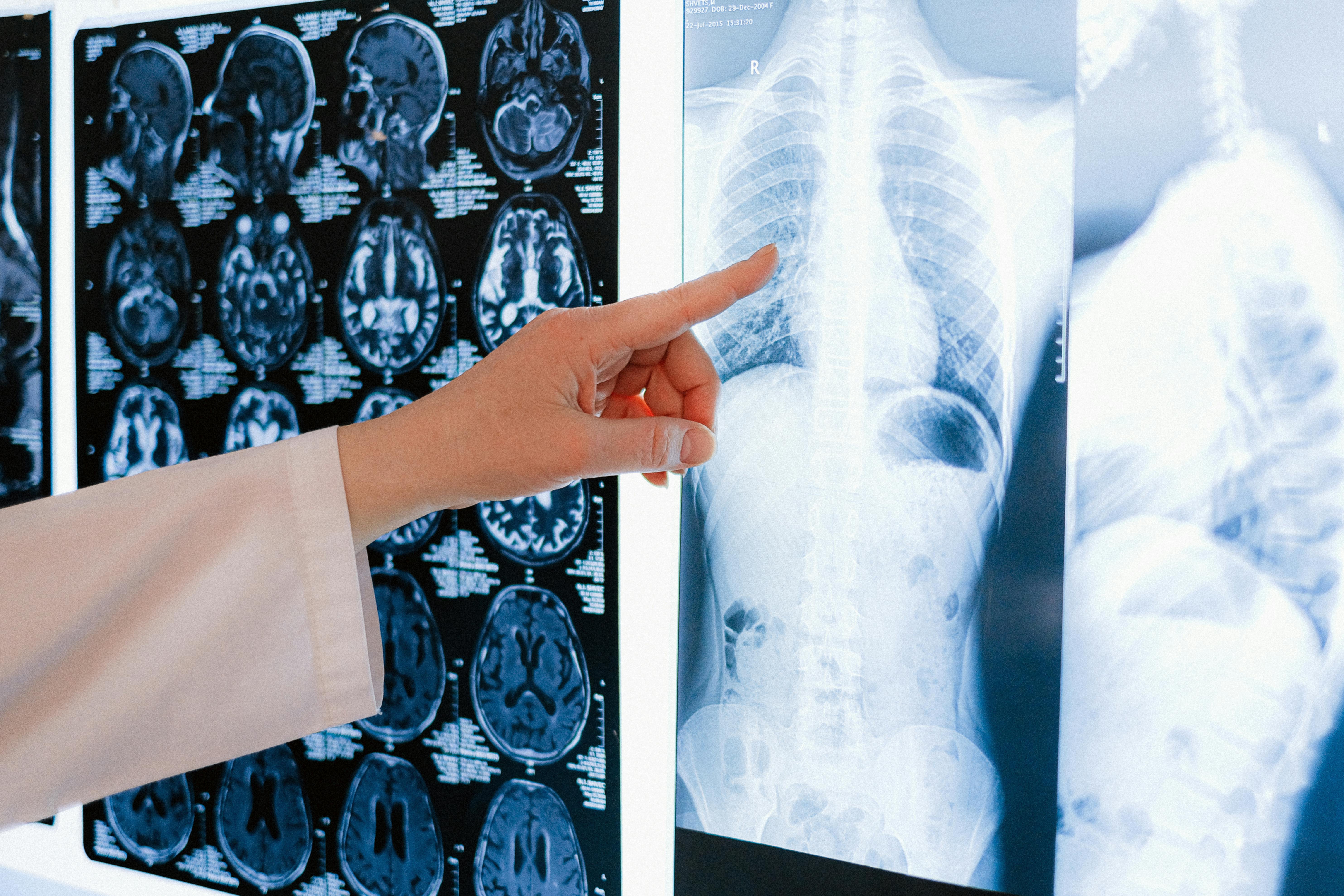 What is PACS? A Comprehensive Guide to Picture Archiving and Communication Systems